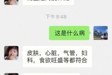 库兴氏综合征