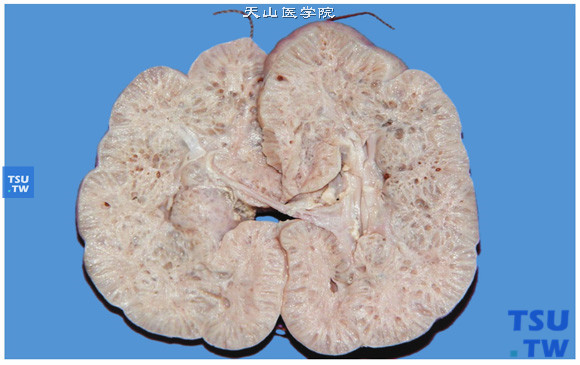 宠物多囊肾痛苦-宠物多囊肾如何治疗有效