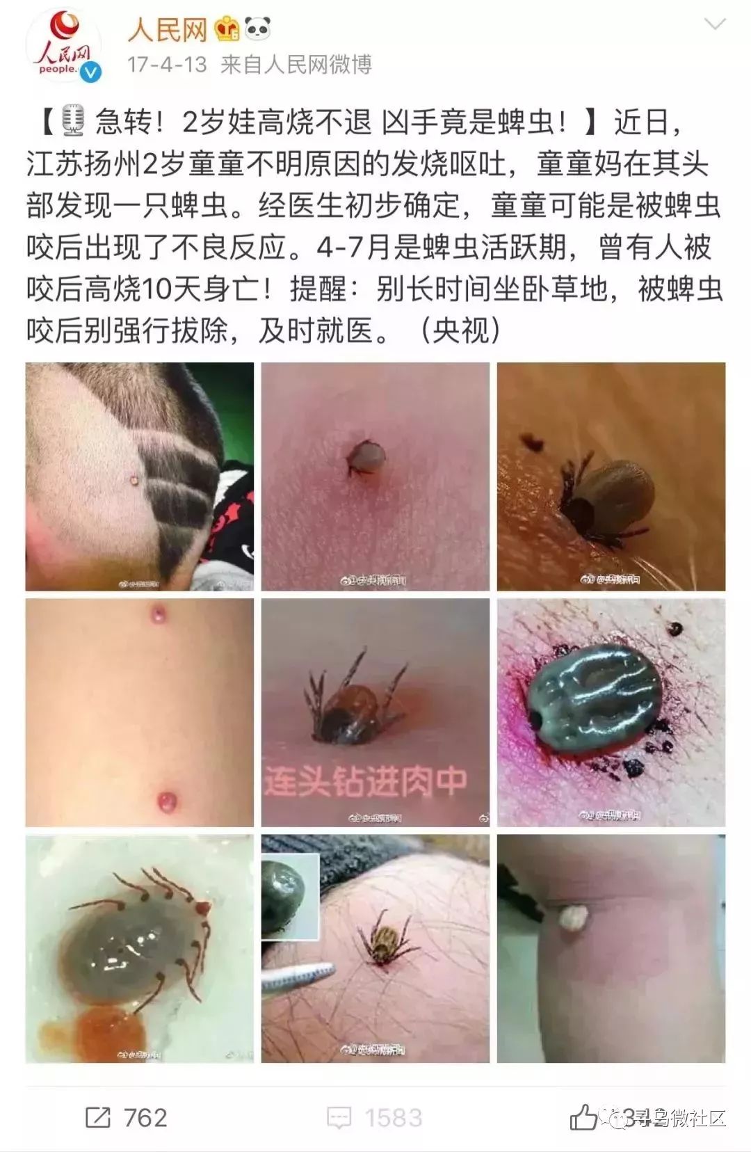 宠物狗蜱虫怎么治疗