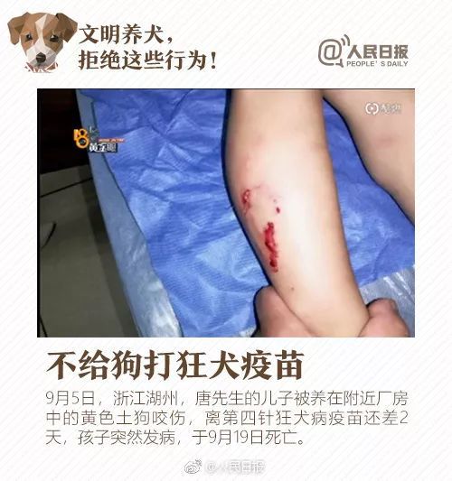 宠物狗打了狂犬疫苗-宠物狗打了狂犬疫苗咬到人有事吗