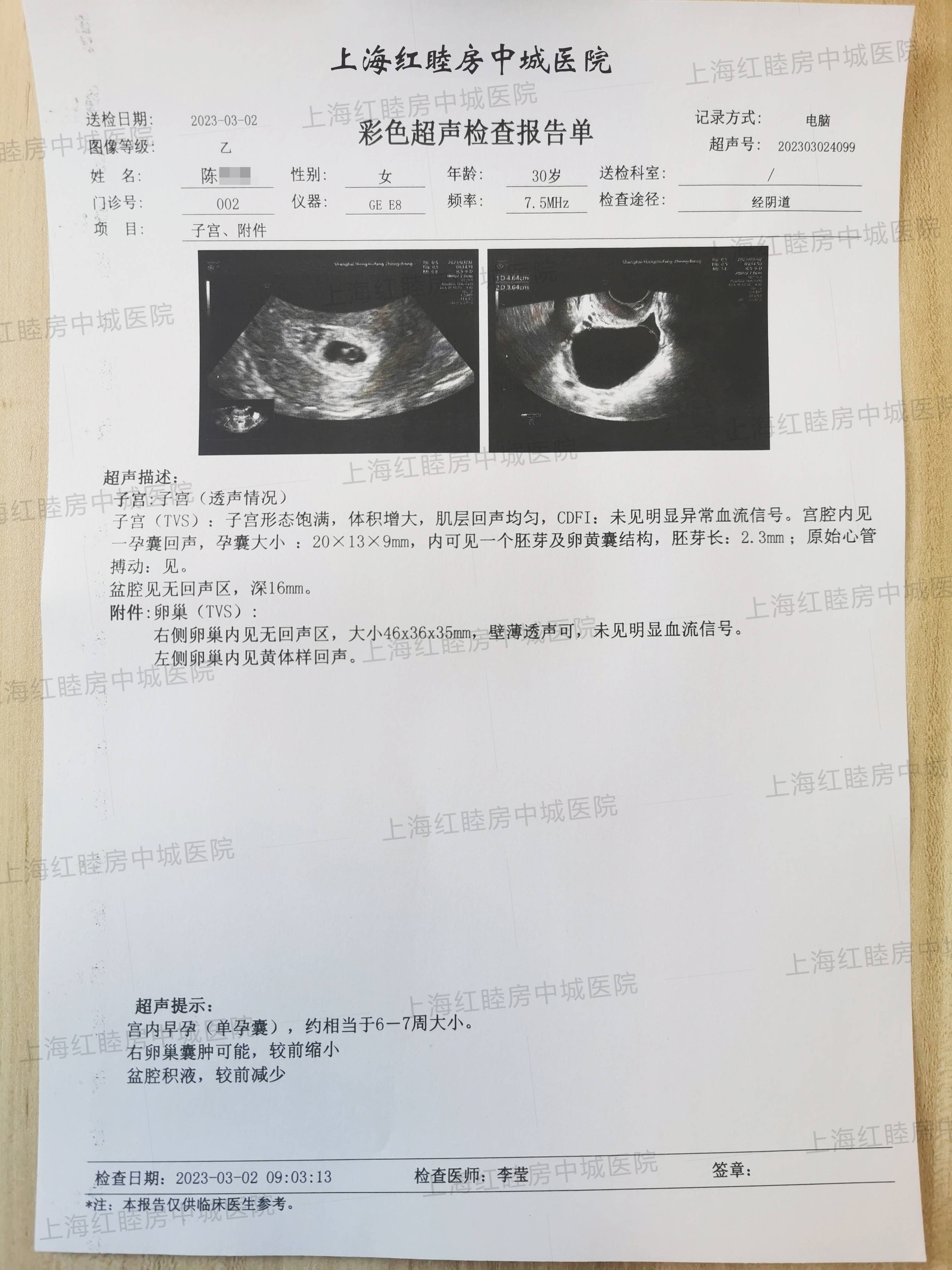 八周是几个月-怀孕第八周是几个月